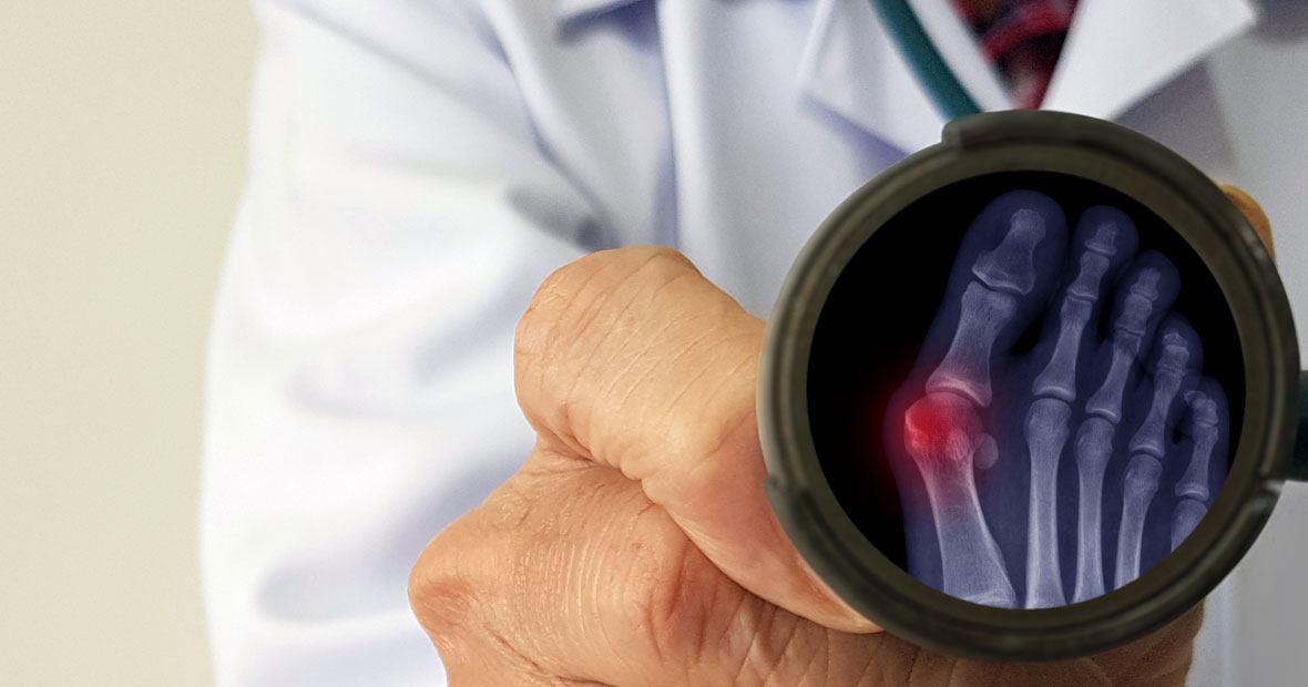 La chirurgie mini-invasive